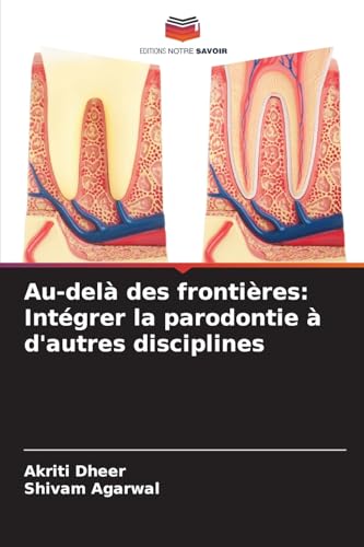 Au-delà des frontières: Intégrer la parodontie à d'autres disciplines