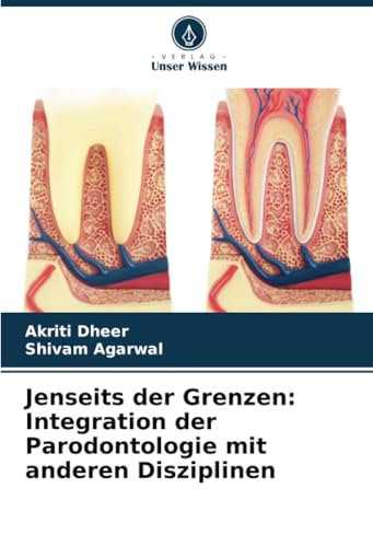 Jenseits der Grenzen: Integration der Parodontologie mit anderen Disziplinen von Verlag Unser Wissen