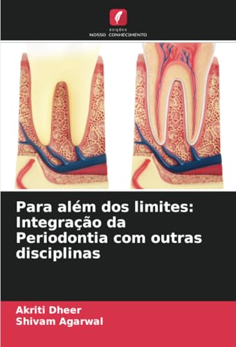 Para além dos limites: Integração da Periodontia com outras disciplinas: DE von Edições Nosso Conhecimento