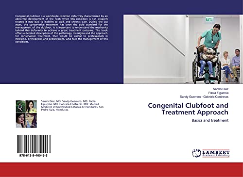 Congenital Clubfoot and Treatment Approach: Basics and treatment