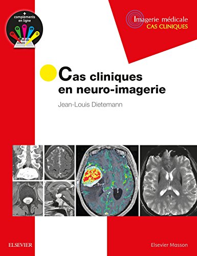 Cas cliniques en neuro-imagerie: Pathologies tumorales