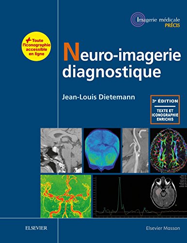 Neuro-imagerie Diagnostique von Elsevier Masson