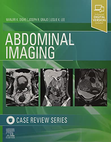 Abdominal Imaging: Case Review Series Abdominal Imaging: Case Review Series von Elsevier