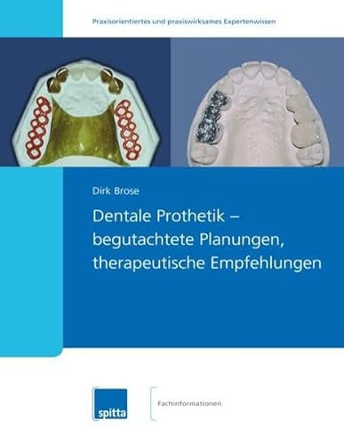 Dentale Prothetik – begutachtete Planungen, therapeutische Empfehlungen von Spitta GmbH