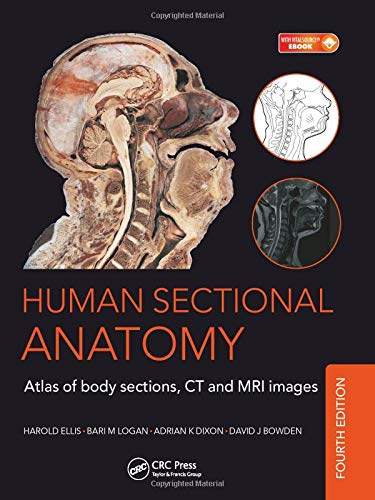 Human Sectional Anatomy: Atlas of Body Sections, CT and MRI Images, Fourth Edition von CRC Press