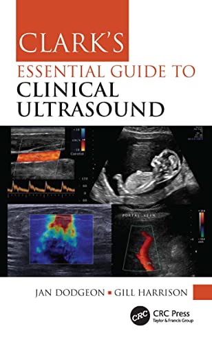 Clark's Essential Guide to Clinical Ultrasound (Clark's Companion Essential Guides) von CRC Press