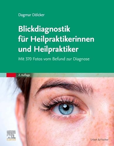 Blickdiagnostik für Heilpraktikerinnen und Heilpraktiker: Mit 370 Fotos vom Befund zur Diagnose von Elsevier