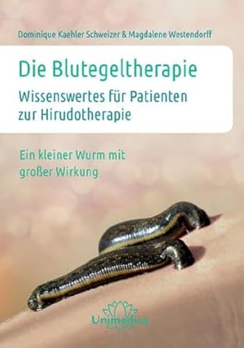 Die Blutegeltherapie: Wissenswertes für Patienten zur Hirudotherapie Ein kleiner Wurm mit großer Wirkung