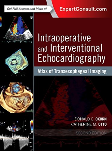 Intraoperative and Interventional Echocardiography: Atlas of Transesophageal Imaging von Elsevier