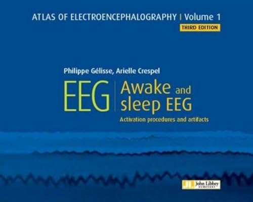 Atlas of Electroencephalography -- Volume 1: Awake and sleep EEG von JOHN LIBBEY