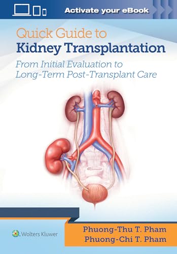 Quick Guide to Kidney Transplantation: From Initial Evaluation to Long-term Posttransplantation Care