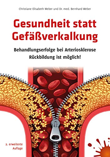 Gesundheit statt Gefäßverkalkung: Behandlungserfolge bei Arteriosklerose - Rückbildung ist möglich!: Behandlungserfolge bei Arteriosklerose – Rückbildung ist möglich 2. erweiterte Auflage! von hsm healthstyle.media