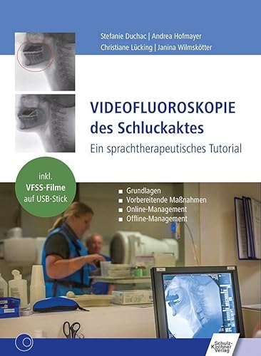 Videofluoroskopie des Schluckaktes: Ein sprachtherapeutisches Tutorial von Schulz-Kirchner Verlag Gm