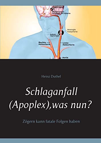 Schlaganfall (Apoplex), was nun?: Zögern kann fatale Folgen haben