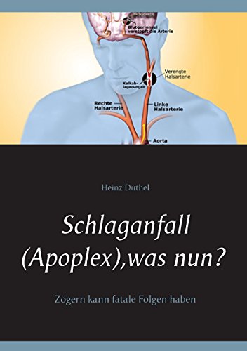Schlaganfall (Apoplex), was nun?: Zögern kann fatale Folgen haben von Books on Demand