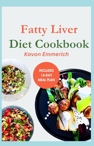 FATTY LIVER DIET COOKBOOK: Low Fat Low Salt Delicious Recipes with Meal Plan for Liver Detox and Repair FATTY LIVER DIET COOKBOOK: Low Fat Low Salt Delicious Recipes with Meal Plan for Liver Detox and Repair von Independently published