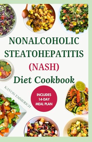 NONALCOHOLIC STEATOHEPATITIS (NASH) DIET COOKBOOK: Delicious Recipes and Meal Plan for Liver Health von Independently published