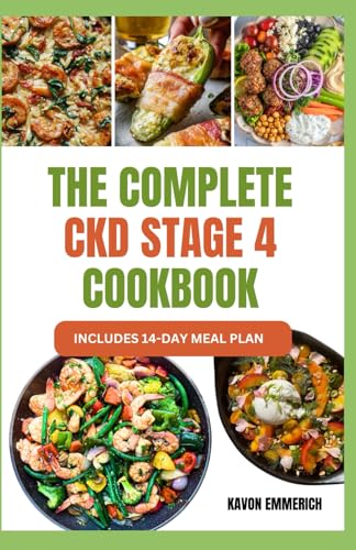 THE COMPLETE CKD STAGE 4 COOKBOOK: Prevent Renal Failure & Manage Kidney Disease with Nutritious & Delicious Low Potassium Diets THE COMPLETE CKD STAGE 4 COOKBOOK: Prevent Renal Failure & Manage Kidney Disease with Nutritious & Delicious Low Potassium Diets von Independently published