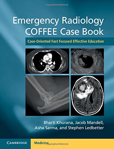 Emergency Radiology COFFEE Case Book: Case-Oriented Fast Focused Effective Education von Cambridge University Press