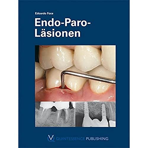 Endo-Paro-Läsionen von Quintessenz Verlag