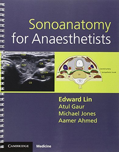 Sonoanatomy for Anesthetists (Cambridge Medicine (Paperback)) von Cambridge University Press