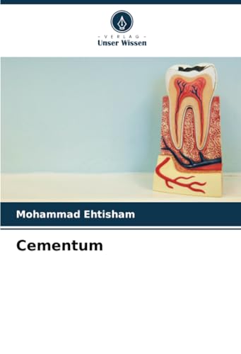 Cementum: DE von Verlag Unser Wissen