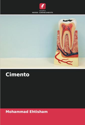 Cimento: DE von Edições Nosso Conhecimento