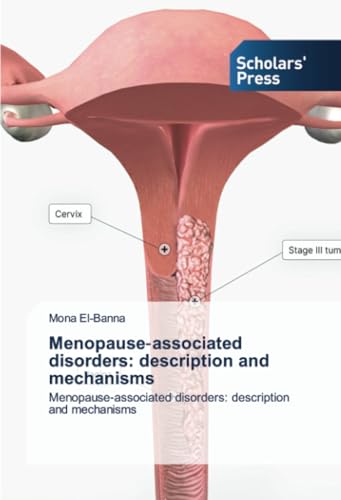 Menopause‐associated disorders: description and mechanisms: Menopause‐associated disorders: description and mechanisms: Menopause-associated disorders: description and mechanisms.DE Menopause‐associated disorders: description and mechanisms: Menopause‐associated disorders: description and mechanisms: Menopause-associated disorders: description and mechanisms.DE von Scholars' Press