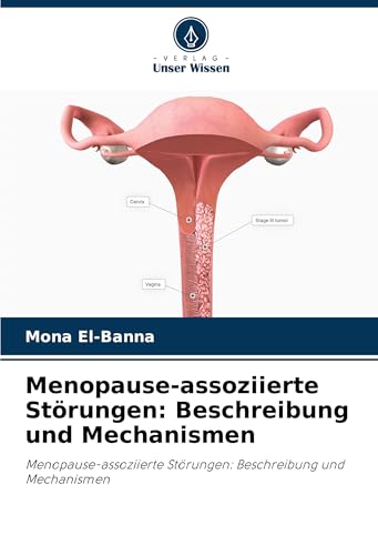 Menopause-assoziierte Störungen: Beschreibung und Mechanismen: Menopause-assoziierte Störungen: Beschreibung und Mechanismen von Verlag Unser Wissen
