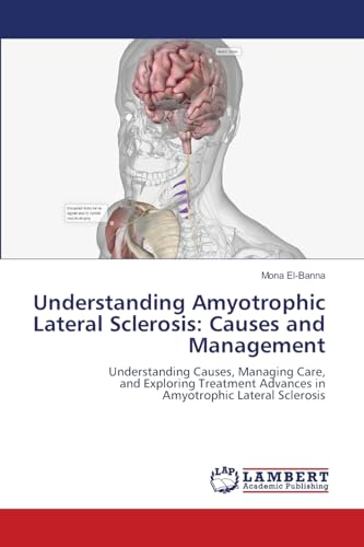 Understanding Amyotrophic Lateral Sclerosis: Causes and Management: Understanding Causes, Managing Care,and Exploring Treatment Advances inAmyotrophic Lateral Sclerosis Understanding Amyotrophic Lateral Sclerosis: Causes and Management: Understanding Causes, Managing Care,and Exploring Treatment Advances inAmyotrophic Lateral Sclerosis von LAP LAMBERT Academic Publishing