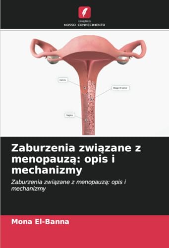 Zaburzenia związane z menopauzą: opis i mechanizmy: Zaburzenia związane z menopauzą: opis i mechanizmy: Zaburzenia zwi¿zane z menopauz¿: opis i mechanizmy Zaburzenia związane z menopauzą: opis i mechanizmy: Zaburzenia związane z menopauzą: opis i mechanizmy: Zaburzenia zwi¿zane z menopauz¿: opis i mechanizmy von Edições Nosso Conhecimento