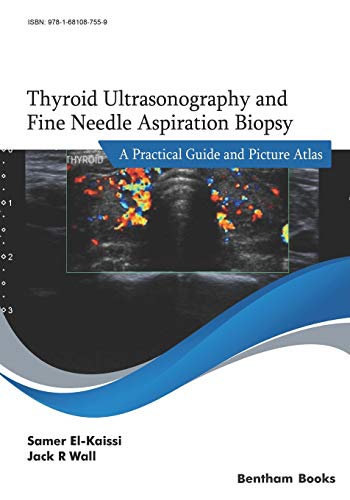 Thyroid Ultrasonography and Fine Needle Aspiration Biopsy: A Practical Guide and Picture Atlas von Bentham Science Publishers