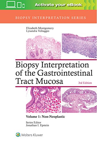 Biopsy Interpretation of the Gastrointestinal Tract Mucosa: Volume 1: Non-Neoplastic von LWW