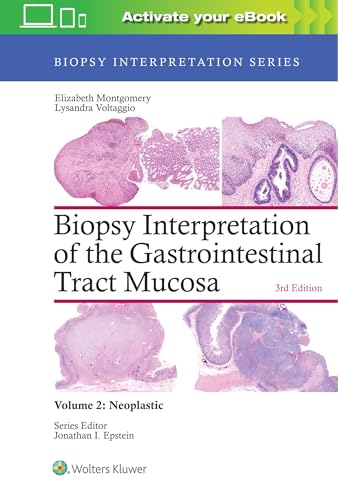 Biopsy Interpretation of the Gastrointestinal Tract Mucosa: Volume 2: Neoplastic: Nonneoplastic von LWW
