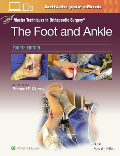 Master Techniques in Orthopaedic Surgery: The Foot and Ankle: Print + eBook with Multimedia von LWW