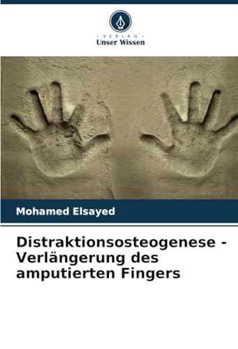 Distraktionsosteogenese - Verlängerung des amputierten Fingers von Verlag Unser Wissen