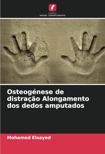 Osteogénese de distração Alongamento dos dedos amputados von Edições Nosso Conhecimento