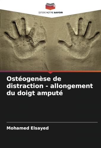 Ostéogenèse de distraction - allongement du doigt amputé von Editions Notre Savoir