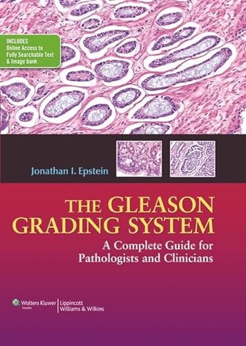 The Gleason Grading System: A Complete Guide for Pathologists and Clinicians