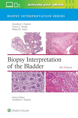 Biopsy Interpretation of the Bladder von Lippincott Williams&Wilki