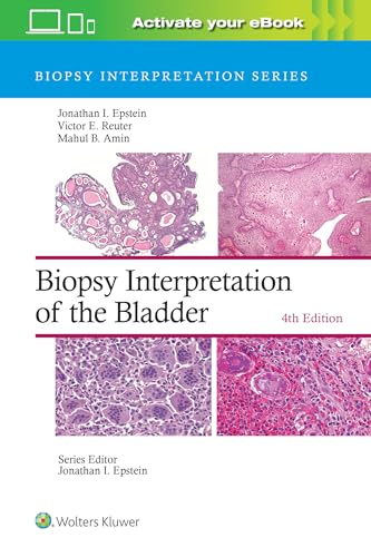 Biopsy Interpretation of the Bladder: Print + eBook with Multimedia von Lippincott Williams&Wilki