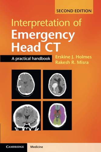 Interpretation of Emergency Head CT: A Practical Handbook von Cambridge University Press