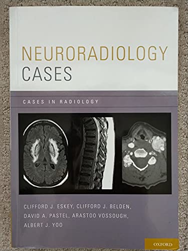 Neuroradiology Cases (Cases in Radiology)