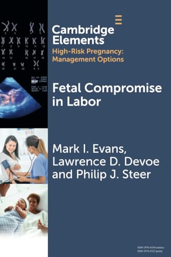 Fetal Compromise in Labor (Elements in High Risk Pregnancy: Management Options) von Cambridge University Press