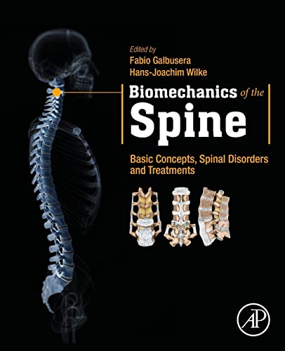 Biomechanics of the Spine: Basic Concepts, Spinal Disorders and Treatments Biomechanics of the Spine: Basic Concepts, Spinal Disorders and Treatments von Academic Press