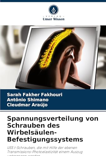 Spannungsverteilung von Schrauben des Wirbelsäulen-Befestigungssystems: USS I-Schrauben, die mit Hilfe der ebenen Transmissions-Photoelastizität einem Auszug unterzogen werden von Verlag Unser Wissen