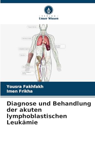 Diagnose und Behandlung der akuten lymphoblastischen Leukämie