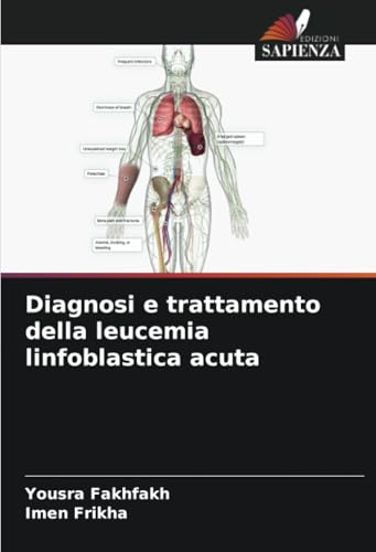Diagnosi e trattamento della leucemia linfoblastica acuta