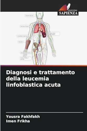 Diagnosi e trattamento della leucemia linfoblastica acuta: DE