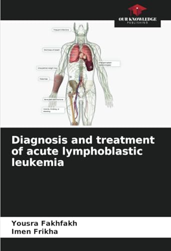Diagnosis and treatment of acute lymphoblastic leukemia: DE von Our Knowledge Publishing